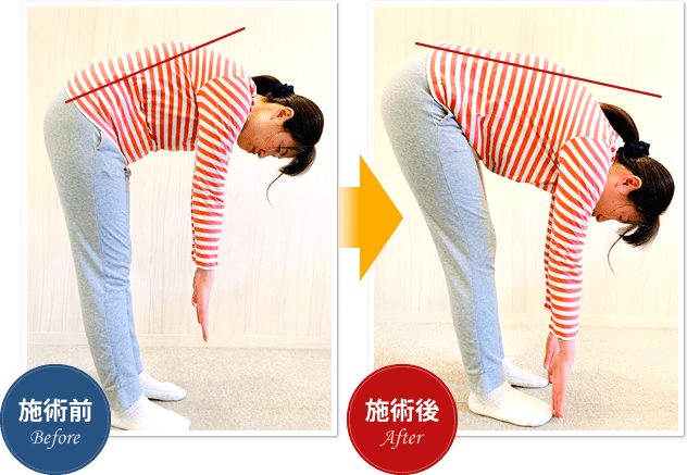 施術前 → 施術後